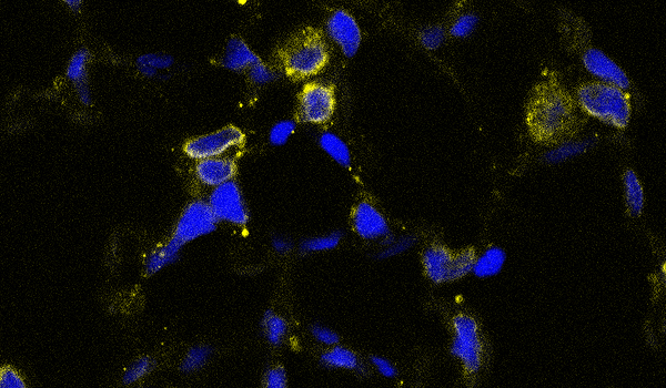 Imagen de microscopía de fluorescencia en la que se observa el aumento de la Lamina-A (en amarillo) en los núcleos (en azul) de las células de alveolos pulmonares sometidos a ventilación mecánica Fuente: CIBERES / Consorcio Centro de Investigación Biomédica en Red, M.P. (CIBER)