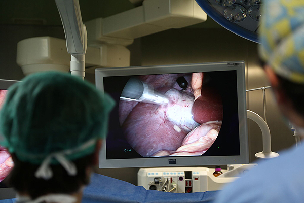 Vista del uso de imanes durante la cirugía Fuente: Hospital Vall d’Hebron