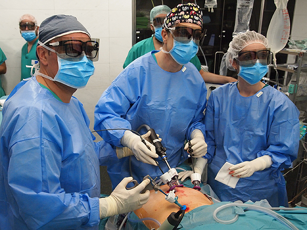 Una intervención quirúrgica por laparoscopia Fuente: Hospital del Mar 