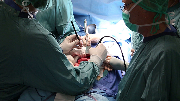 Vista de la cirugía Fuente: Hospital Universitari Vall d’Hebron 