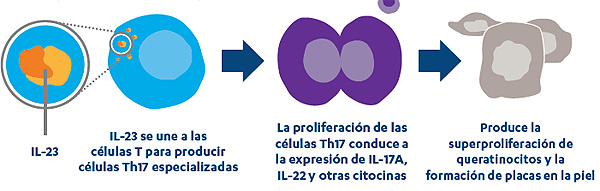 Interleucina-23 (IL-23): Activadora de células Th17 La IL-23 estimula la supervivencia y expansión de las células Th17 para iniciar la ruta inflamatoria mediada por la inmunidad de la psoriasis Fuente: Blauvelt A, Lebwohl M, Bissonnette R. IL-23/IL-17A dysfunction phenotypes inform possible clinical effects from anti-IL-17A therapies. J Invest Dermatol 2015;135(8):1946–1953. / Bachelez H. Interleukin 23 inhibitors for psoriasis: not just another number. The Lancet 2017;390:208–210. Difusión: Janssen - Johnson & Johnson / Berbés Asociados 