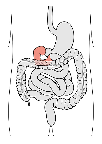 Diagrama esquemático del tracto gastrointestinal: el duodeno esta resaltado Autor/a de la imagen: Olek Remesz (wiki-pl: Orem, commons: Orem) Fuente: Wikipedia