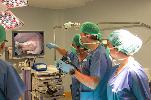 La endoscopia, usada para tratar problemas derivados del divertículo de Zenker Fuente: Hospital Universitario Virgen del Rocío 