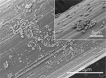 Micrografías SEM del biofilm de S. aureus formado en la superficie de la malla quirúrgica Autor/a: ©ICFO Fuente: ICFO / B. BRAUN