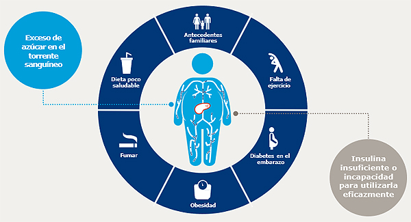La DM2 puede ser consecuencia de múltiples factores Fuente: International Diabetes Federation. Available at: http://www.diabetesatlas.org/. Last accessed: 12 January 2018. Difusión: Novo Nordisk / Cícero Comunicación 