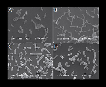 Microscopía electrónica de barrido de todas las cepas bacterianas de HOWARU® Restore: A) Lactobacillus acidophilus NCFM®; B) Lactobacillus paracasei Lpc-37; C) Bifidobacterium lactis Bl-04; D) Bifidobacterium lactis Bi-07 Fuente: STADA