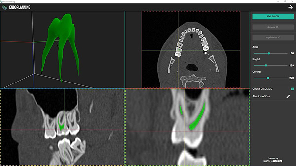 Nuevo software empleado en odontología Fuente: Digital Anatomics / AEDE
