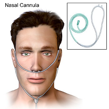 Sonda nasal en forma de ‘gafas’ nasales o ‘gafas de oxígeno’ Autor/a de la imagen: BruceBlaus  Fuente: Wikipedia 