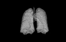 pulmones