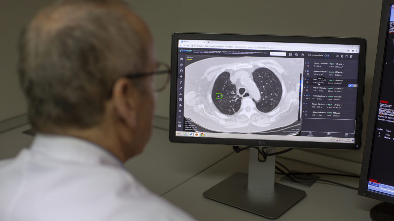 Inteligencia artificial anatomopatológica y medicina respiratoria