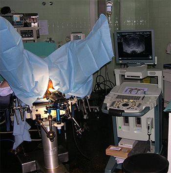 biopsia de próstata transperineal técnica)