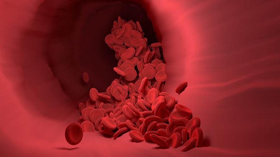 portada) sangre sangrado hemofilia hemofílico hemorragia - Farmacosalud