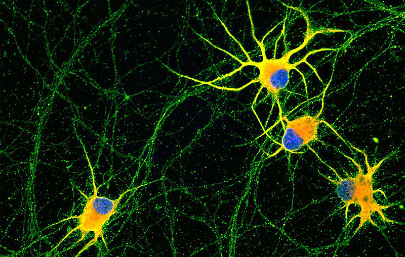 (portada) Neuronas humanas creciendo