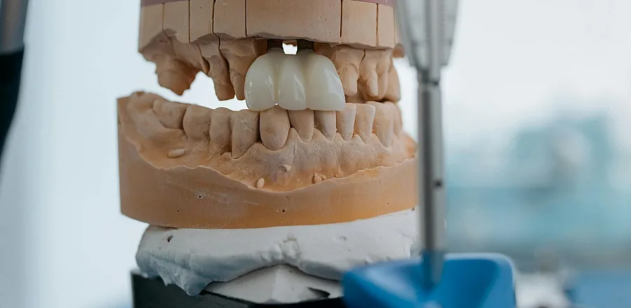 (portada) odontología recurso edentulismo edéntulo edéntula diente dental dentista pieza muela