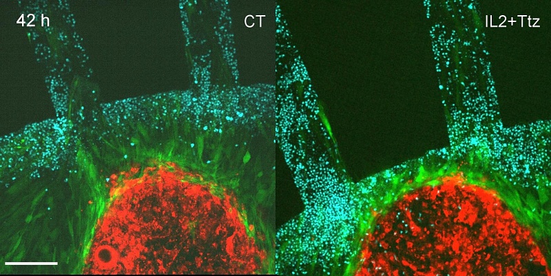 (portada) MIRO fibroblastos esferoide tumoral células immunitarias