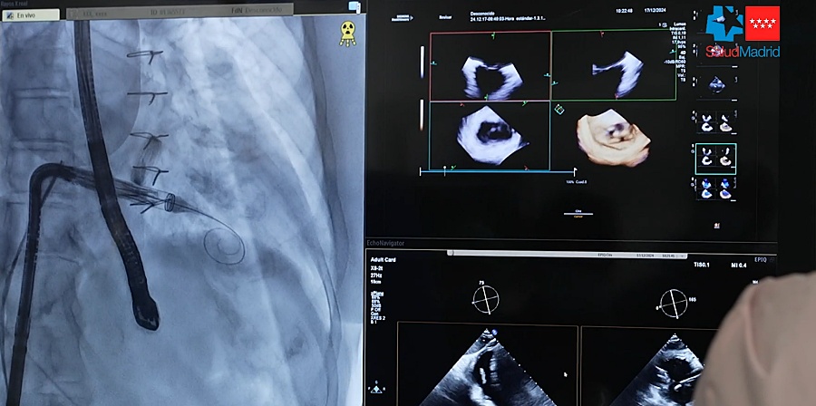 (portada) ecografía 4D cardiaca