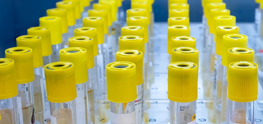 (portada 2) laboratorio laboratorio5 tubos tubitos amarillas