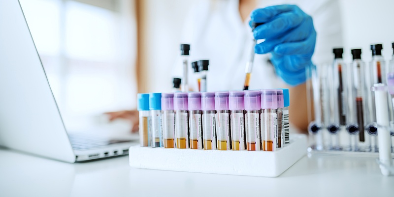 (portada 2) laboratorio5 laboratorio tubos ensayo muestras sangre científica mascarilla ordenador