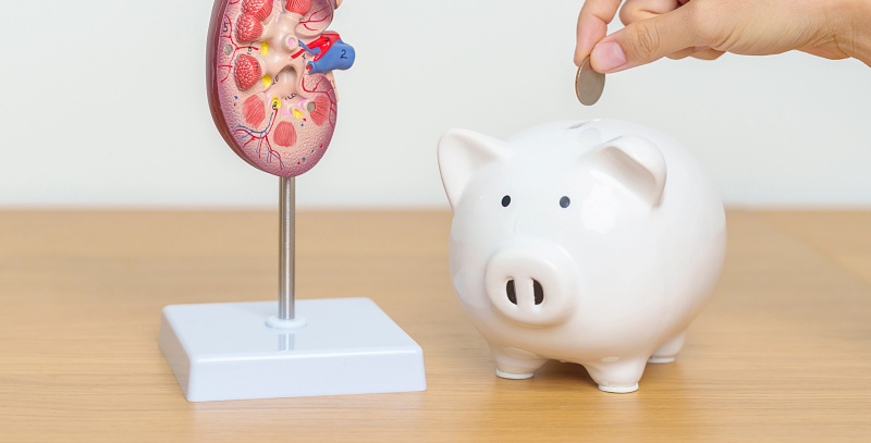 (portada) modelo anatómico riñón humano simbolismo dinero hucha renal