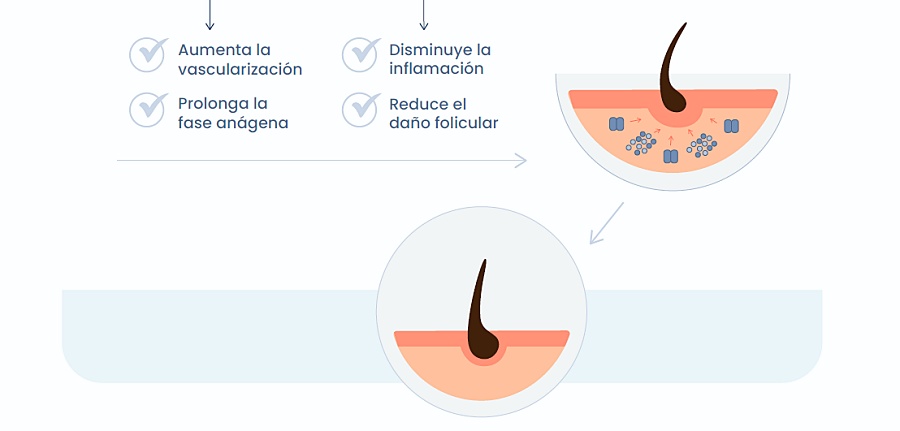 (portada) infografía alopecia ratones 2 ok