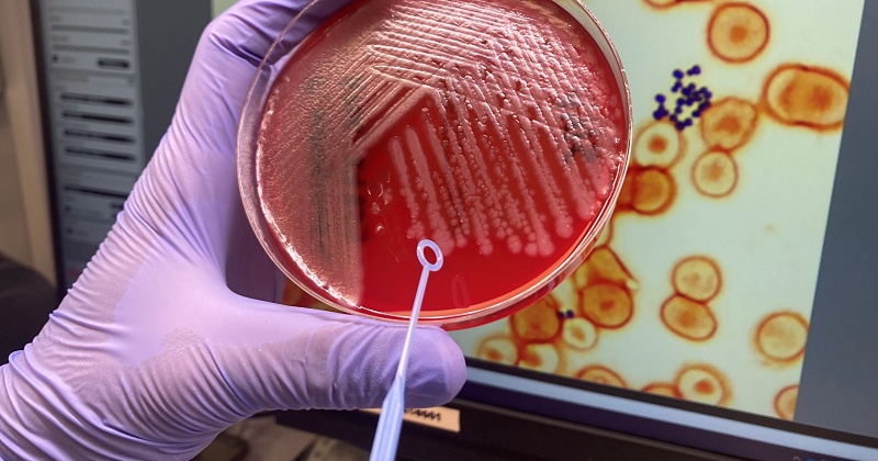 (portada) cultivo de Pseudomonas aeruginosa