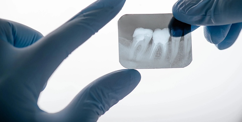 (portada) dentista odontología odontólogo rayos x radiografía diente dientes dentadura