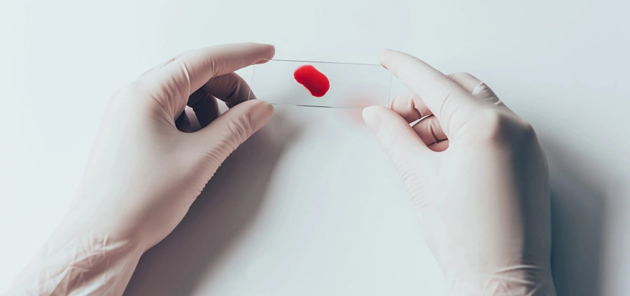 (portada) muestra sangre sanguíneo laboratorio5 laboratorio placa manos guantes