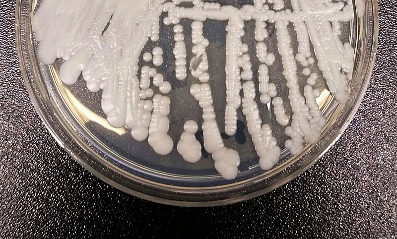(portada) hongo candida auris candidozyma auris C auris
