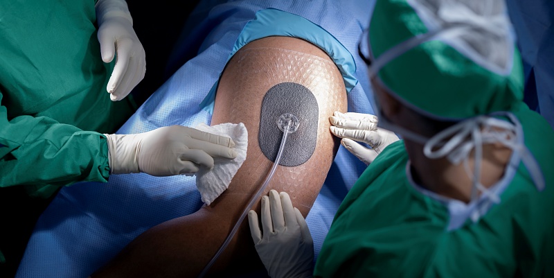 (portada) VAC Peel and Place Dressing